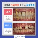 하하하치과의원 네이버블로그