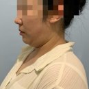 바라던 핏 이미지