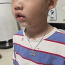 나은길외과의원 | 38개월 유아 물놀이 사고, 턱 찢어짐 사고,대처 방법 및 병원 추천 (분당 더 나은 성형외과의원)