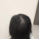 모모란