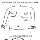 (만화)군생활 하다가 대상포진 걸린 썰 이미지