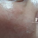 휘푸드 이미지