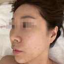 에스와이인주3공장 | 서현피부관리 유명한 에스와이뷰티크 분당서현점에서 여드름 관리 받은 후기