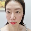 보습 미스트 아마로스 O2스프레이 후기