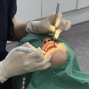 위드미치과의원 | 평택 치과에서 진행 중인 아이 교정 1년 후기