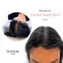서원역두피문신 탈모,헤어라인 고민 끝