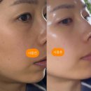 큐어 소나 리쥬 코드 앰플/롤러/크림 다이소 품절 화장품 내 돈 내산 솔직 후기 또 사러 간 제품 사용법...