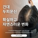 건대 두피문신 확실하고 자연스러운 변화 후기