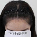 한올성형외과의원 이미지