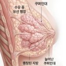 (주)거상산업개발 | 가슴거상수술 예약까지 잡았다가 취소한 이유