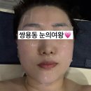 쌍용동피부관리 눈의여왕 VVS 무결점 관리 후기