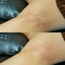 서면왁싱 부산왁싱 페네트레 왁싱샵 마산미용실 댓거리미용실 창원미용실 창원미용실추천 화미주아티클...