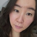 진*기 | 홍조크림 더마스퀘어 레드스킵 재생크림으로 붉은기 편안해진 리얼후기