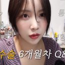 드디어 올려보는 가슴수술 6개월차 후기! 에 큐앤에이를 곁들인