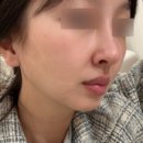 더라푼 왁싱 이천점