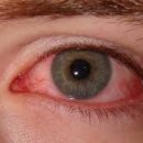 블루필드 이미지