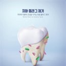 연세미소애치과의원 네이버블로그