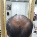 일대일미용실 & 일대일가발