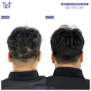 탈모왕 본점 이미지