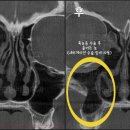 안코비어 이미지