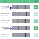 수정-30 | 30대 다낭성 임신준비. 🫩나팔관조영술 후기, 인공수정/시험관 시작! (산전 무료검사)