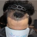 압구정모비앙의원 이미지