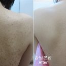 강남리유한의원 네이버블로그