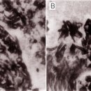베어디대게 (Bairdir Crab, Chionoecetes bairdi)의 자낭균 감염 Black mat syndrome (B 이미지