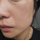 뷰티,하나하 | 동래피부관리 두피관리 한번에 가능한 라별하뷰티 리얼 후기