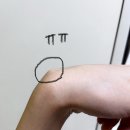 코뿔소한의원 | 고양이 속이기, 손목 결절종, 뜨개질 금지령