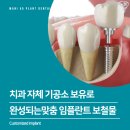 김포치과기공소 이미지