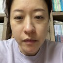 인셀덤 3종세트 3주 솔직한사용후기 부작용? 명현? 개선된점 등