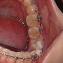 가지런이 치과교정과 치과의원 이미지