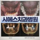 마리오디지털치과기공소 | 부산 치과병원 디지털 임플란트 파헤치기!
