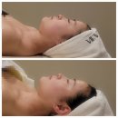 씨유 중구명동점 | 명동 피부관리 뷰태에스테틱 뱀부테라피 후기 가격