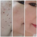 메딕스셀 사용자들 후기