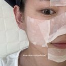 지니 소프트 | 광주 상무지구 피부관리 멜로우왁싱 소프트 플라즈마 후기