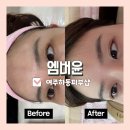 여흥로33번길~소양로 | 여주하동피부샵 엠버윤 스킨플래닝 세라링 재방문 했어요~