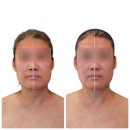정형에스테틱 | "얼굴이 달라지기 전에 몸이 먼저 가벼워졌다, 강동구 정형뷰티어겐 후기"