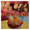 블루덴치과의원 이미지