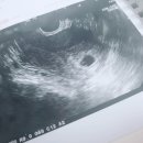 W(더블유)여성병원 이미지