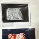 무언가 연재중 11 - 출산