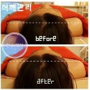 진스케어