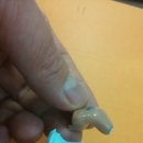 덴마크 오티콘보청기 인천부평센터 이미지