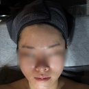 미를 그리다 피부관리 대구 본점 | 에이원뷰티그룹 대구본점 이중턱에 효과적인 미레브 관리 후기