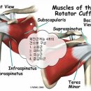 어깨회전근개파열로 인한 어깨통증 이미지