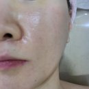 브레라인코리아 | 광명 철산 피부관리, 경력 23년의 원장님께 받는 금손 관리, 1회만에 밝아진 피부, 금손스킨앤바디