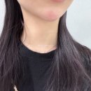 [광주피부과]광주 보톡스잘하는곳/당신의봄의원 솔직후기/ 상무지구 피부과/광주 턱끝필러/광주필러...