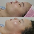 (주)럭셔리뷰티칠곡북삼점 | 북삼 피부관리 잘하는 NU뷰티살롱 매직글로우로 화장 걱정 끝!