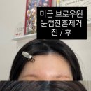 브로우원
